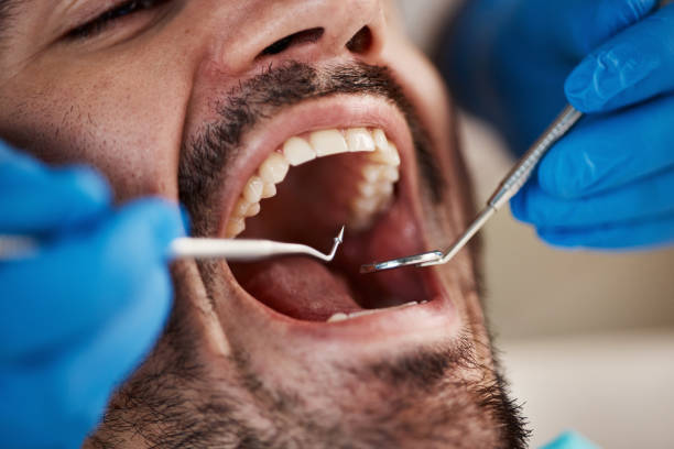 Best Same-Day Emergency Dental Services in Delphos, OH
