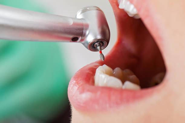 Best Weekend Emergency Dentist in Delphos, OH